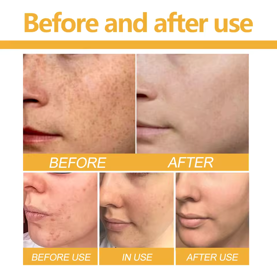 Turmeric Kojic Acid Cleansing Soap